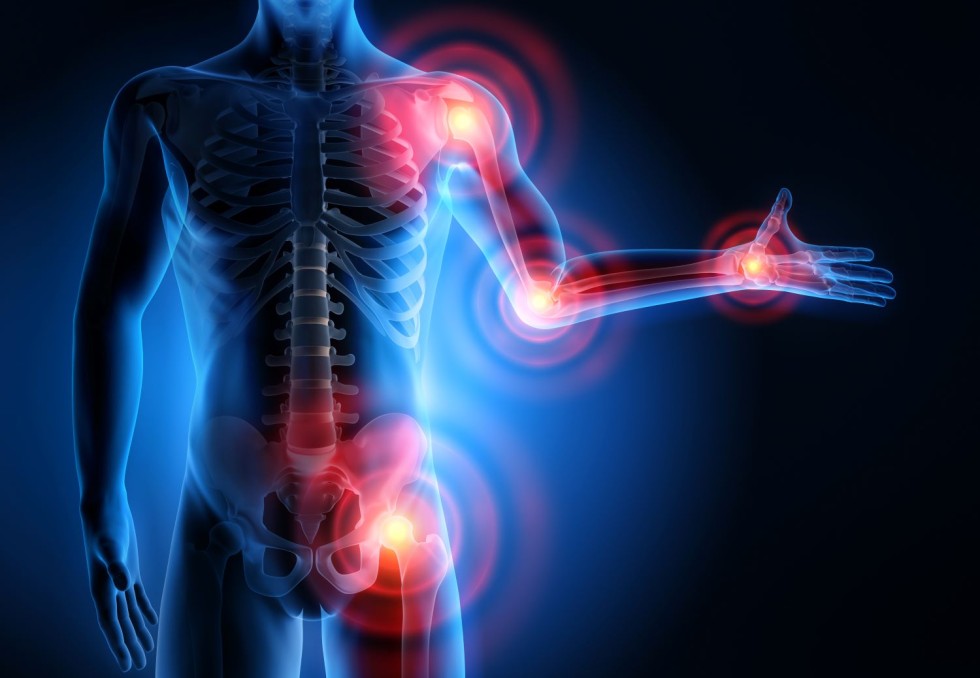 Rhumatismes inflammatoires