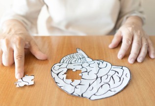 Alzheimer