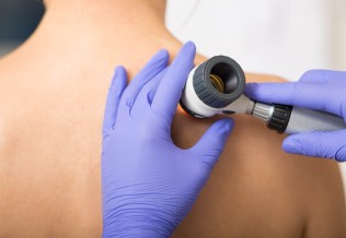 dermato