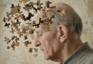 Alzheimer