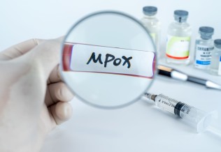 Mpox