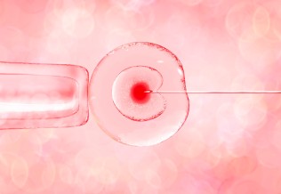 infertilité-ovocyte